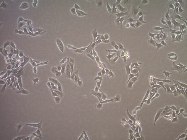 sLT-RMS Spontaneous Lung-tropic RET Melanoma-sorted Mouse Cell Line ...